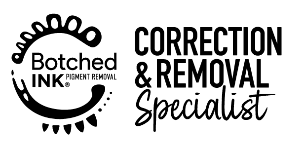 botched ink tattoo removal newcastle