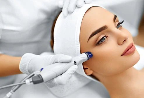 microdermabrasion facial