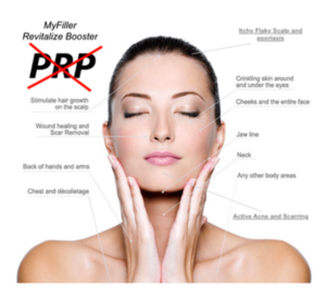 myfiller hair and booster - a new alternative to PRP